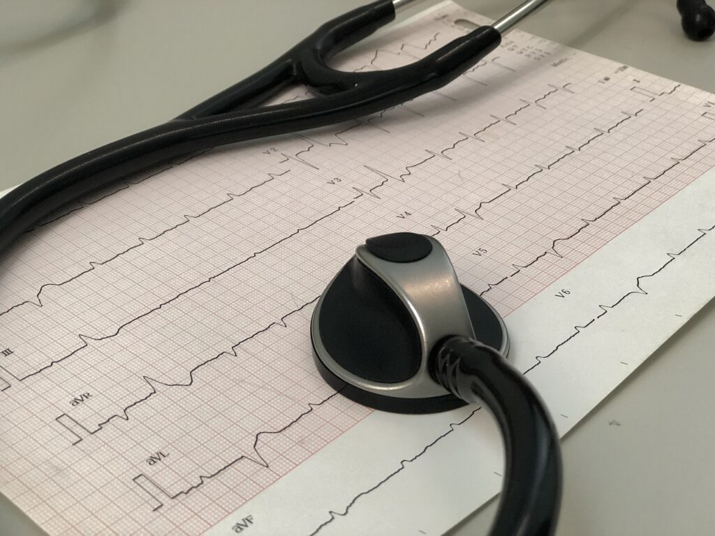 ecg
